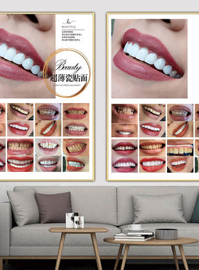 超薄瓷贴面海报牙贴面挂画牙齿美白宣传画纳米炫齿冰瓷美牙广告图