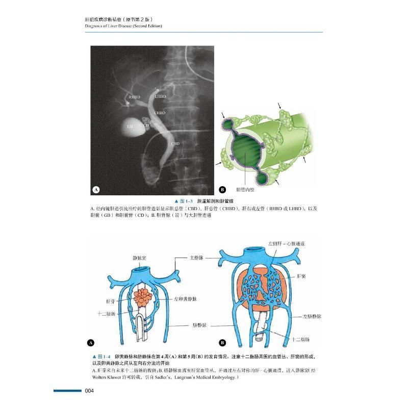 RT正版 肝脏疾病诊断精要9787523601044 原中国科学技术出版社有限公司医药卫生书籍