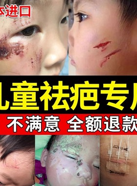 祛疤膏去疤痕修复脸部痘坑痘印凹洞增生儿童手术伤疤除疤正品日本