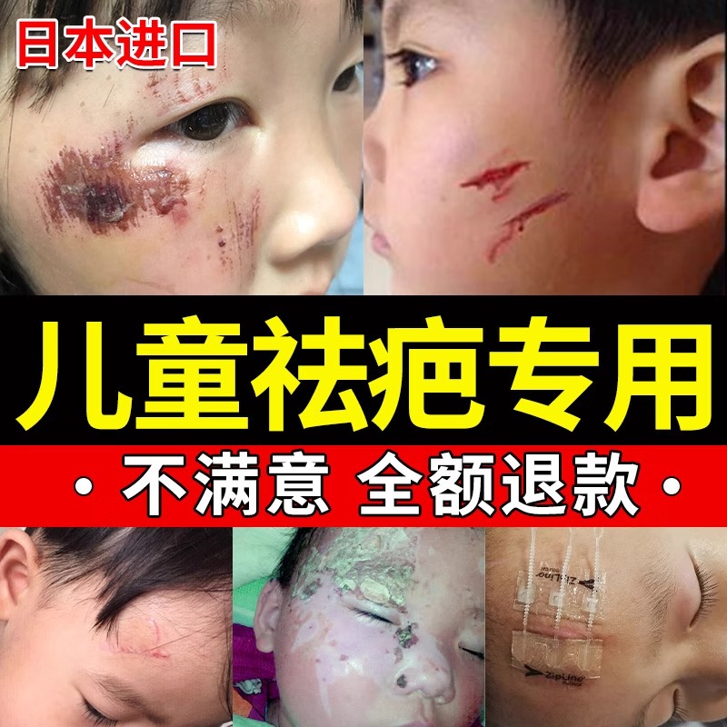 祛疤膏去疤痕修复脸部痘坑痘印凹洞增生儿童手术伤疤除疤正品日本