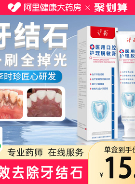 去牙结石牙膏溶解专用洗牙齿污垢除牙石去牙渍牙垢黄牙速效神器