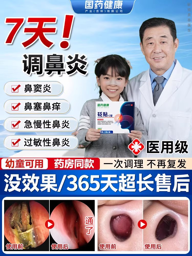 国药健康礼医生鼻炎砭贴过敏性急慢性鼻窦炎剂流鼻涕鼻塞鼻痒MM5