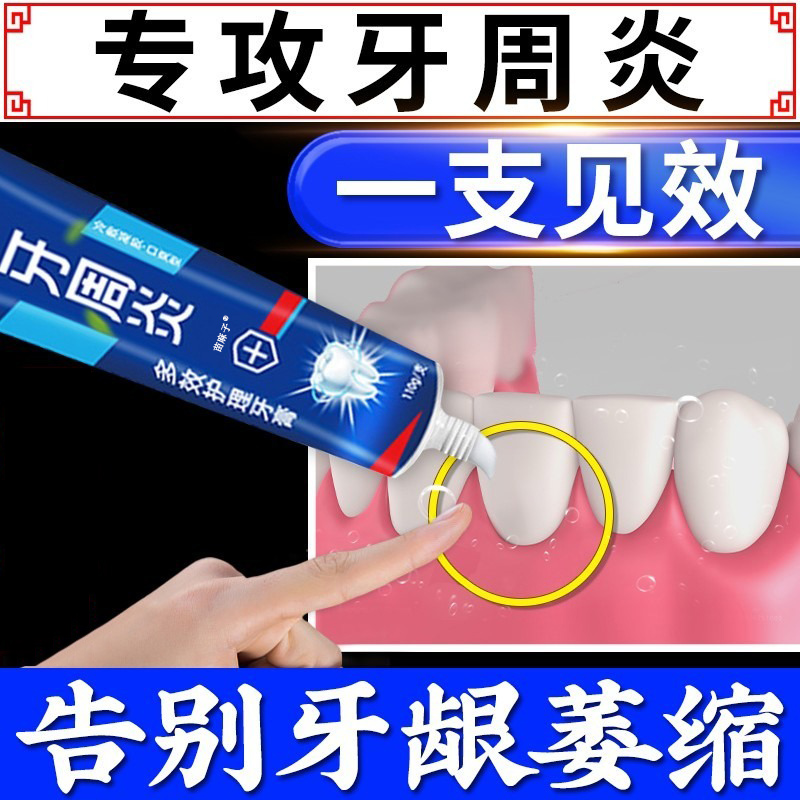 牙周炎专用牙膏牙龈萎缩牙齿松动出血肿痛不治疗修复抗敏感牙膏