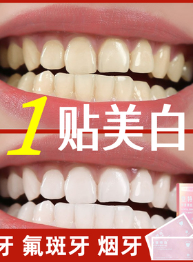 牙贴美白去黄洁白牙齿变白神器速效去牙渍氟斑牙四环素牙强效贴片