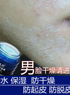 男脸干燥起皮修复霜掉皮面爆皮脱皮退皮起干皮脸部护肤品补水保湿