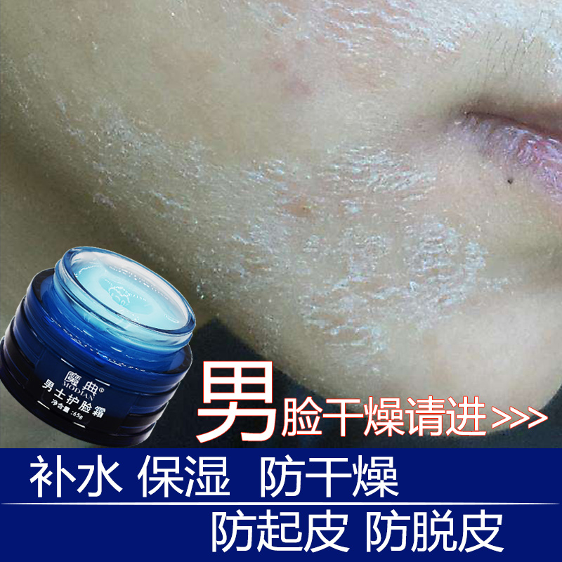 男脸干燥起皮修复霜掉皮面爆皮脱皮退皮起干皮脸部护肤品补水保湿