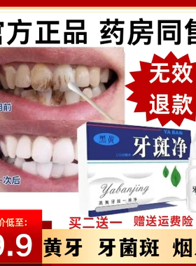 牙斑净牙菌斑牙齿美白速效黄牙正品专去除牙烟渍神器氟斑牙旗舰店
