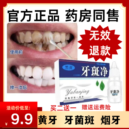 牙斑净牙菌斑牙齿美白速效黄牙正品专去除牙烟渍神器氟斑牙旗舰店
