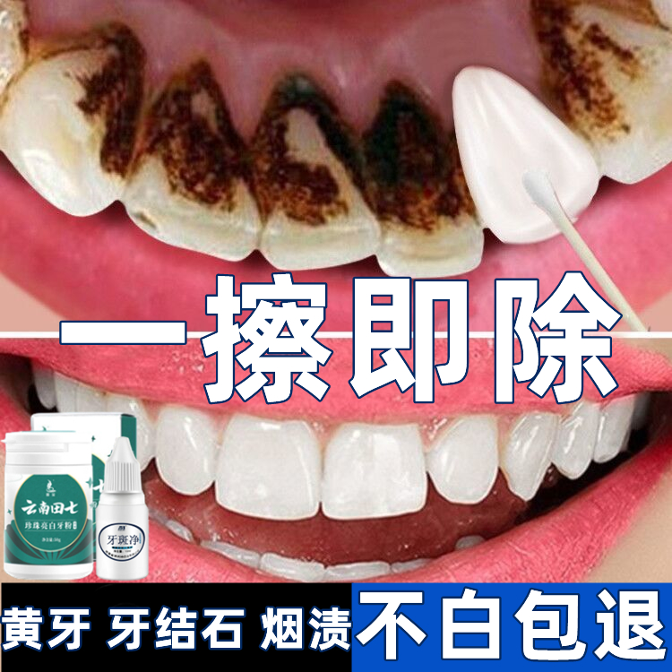 洗牙粉去黄洗白去口臭美白速效黄牙洗牙齿污垢除牙石烟渍清洁神器