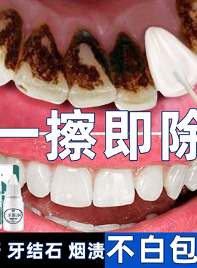 洗牙粉去黄洗白去牙垢美白速效黄牙洗牙齿污垢除牙石烟渍清洁神器