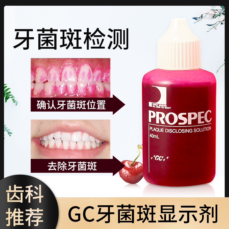 日本GC口腔牙菌斑显示剂 指示剂正畸儿童牙齿清洁 染色液牙垢检测