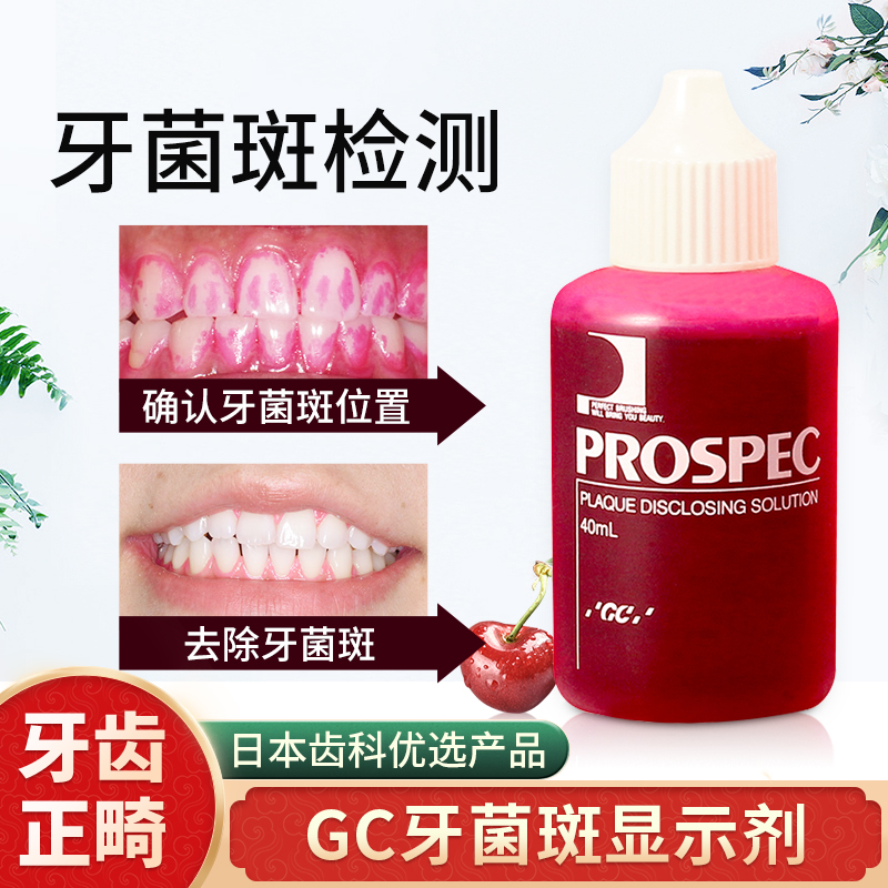 日本GC口腔牙菌斑显示剂 指示剂正畸儿童牙齿清洁 染色液牙垢检测