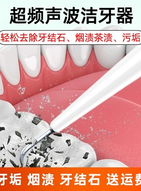 超声波洁牙器牙结石牙垢去除器牙齿美白洗牙神器美牙仪口腔镜清除