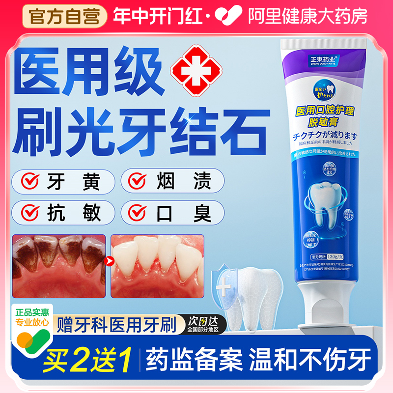 去牙结石牙膏速效溶解牙石黄牙专用洗白牙齿污垢去除烟渍牙垢神器