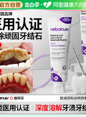 牙结石牙膏专用洗牙齿溶解污垢去牙渍去除器神器牙石黄牙速效