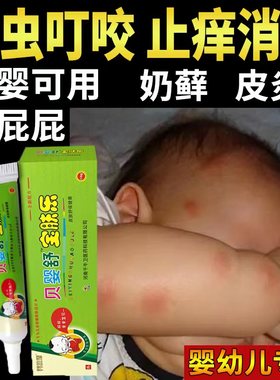 婴宝湿疹霜专用无婴幼儿童口水疹宝宝屁股干性湿疹膏痒止抑菌乳膏