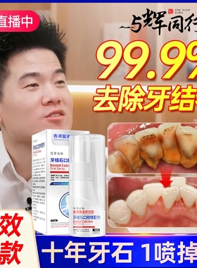牙结石去除器溶解漱口水膏速效洗牙齿污垢除牙石牙黄牙垢清除神器